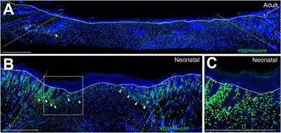 Modulating embryonic signaling pathways paves the way for regeneration in wound healing